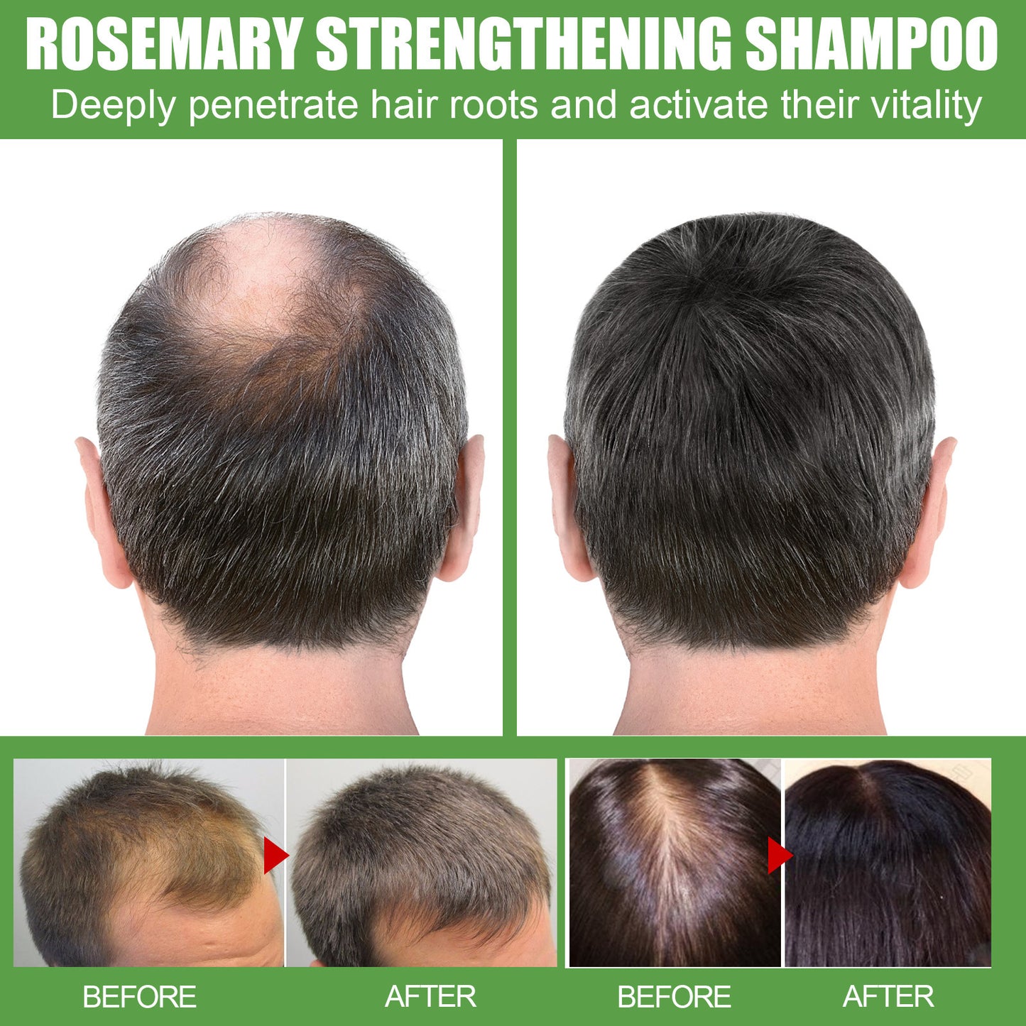 Rosemary Hair Growth Shampoo Thick Anti Loss Damage Scalp Natural Moisturizing