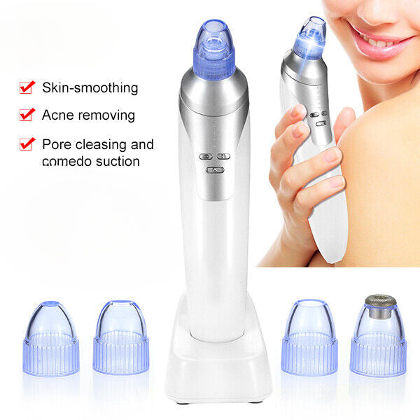 1 SET UBS Facial Blackhead Remover Vacuum Face Pore Pimple Suction Dermabrasion Tool