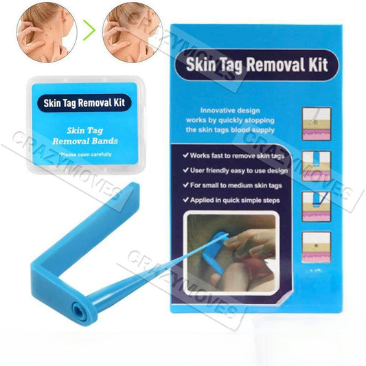 Skin Tag Remover Kit for Fast & Effective Skin Tag Removal VIC