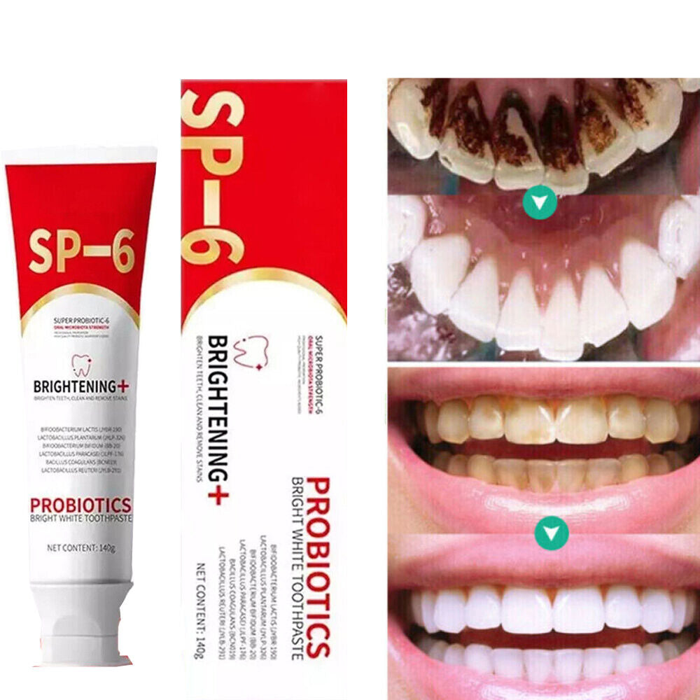 SP-6 Probiotic Toothpaste,Sp-6 Toothpaste Whitening