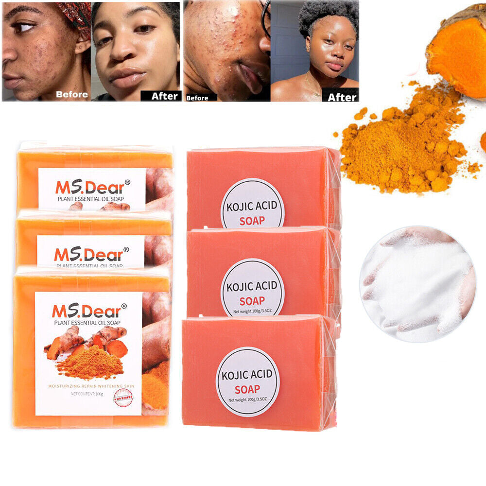 2Pcs Tumeric Soap Skin Whitening Dark Spots lightening Acne Brightening Turmeric