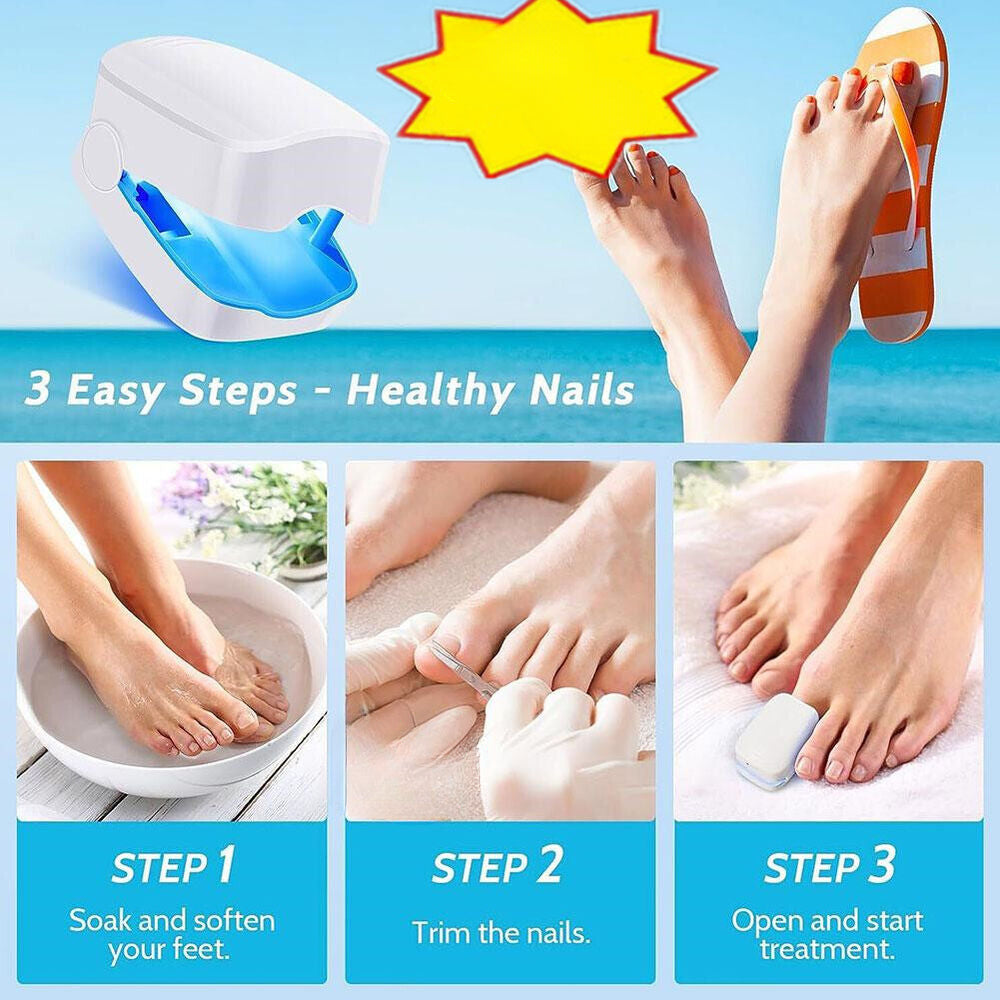 Nail Fungus Laser Device Light Therapy Antifungal Onychomycosis Toes Treatment