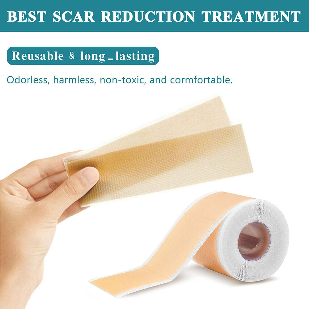 Silicone Gel Sheet Patch Medical Scar Removal Wound Skin Repair Treatment Tape