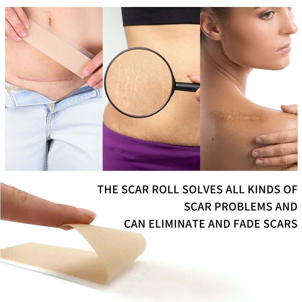 1.5M/Roll Silicone Gel Sheet Patch Scar Removal Wound Skin Repair Treatment Tape