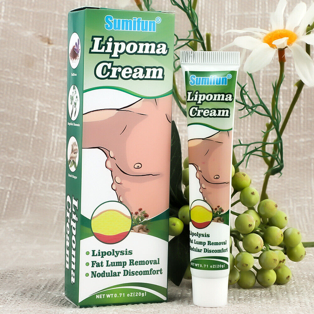 1 x Lipoma Cream Fat Lump Removal Treatment Skin Swelling Exfoliating Ointment