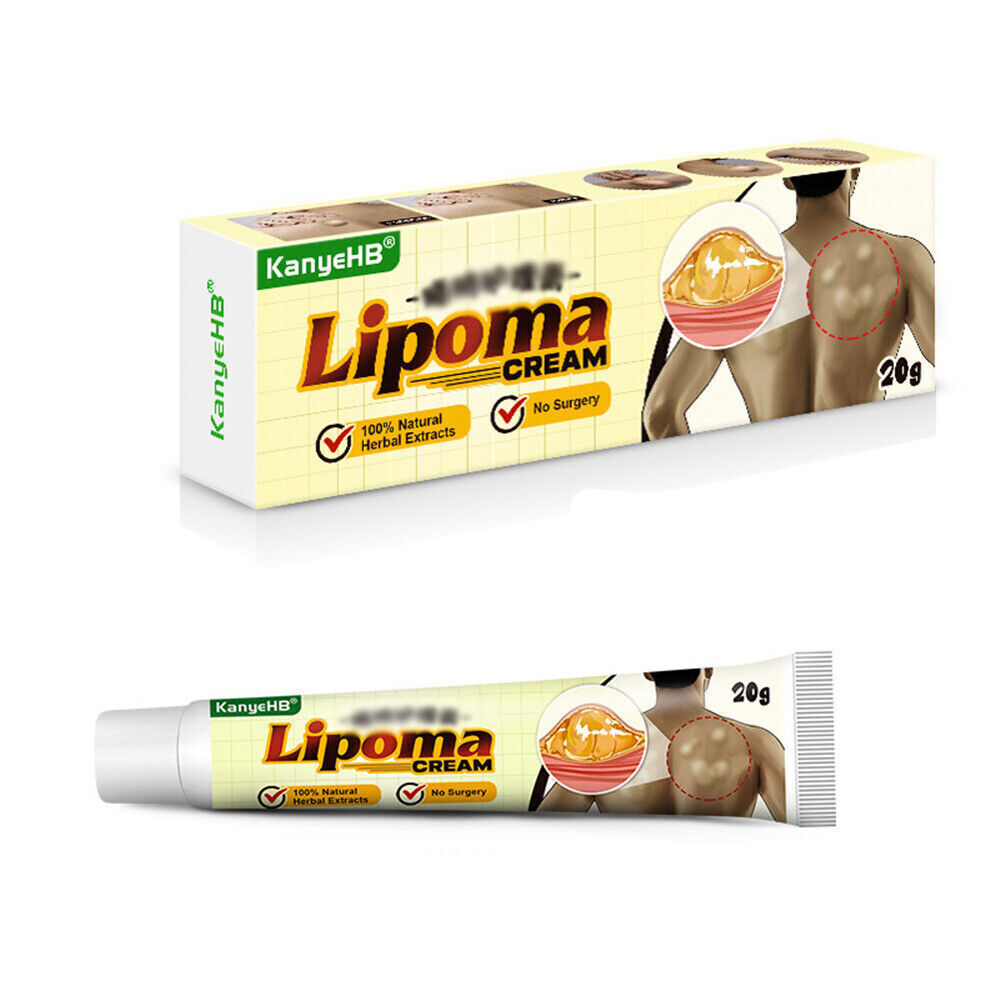 Lipoma Removal Cream Treatment Skin Swelling Ointment Exfoliating Pain Relief`