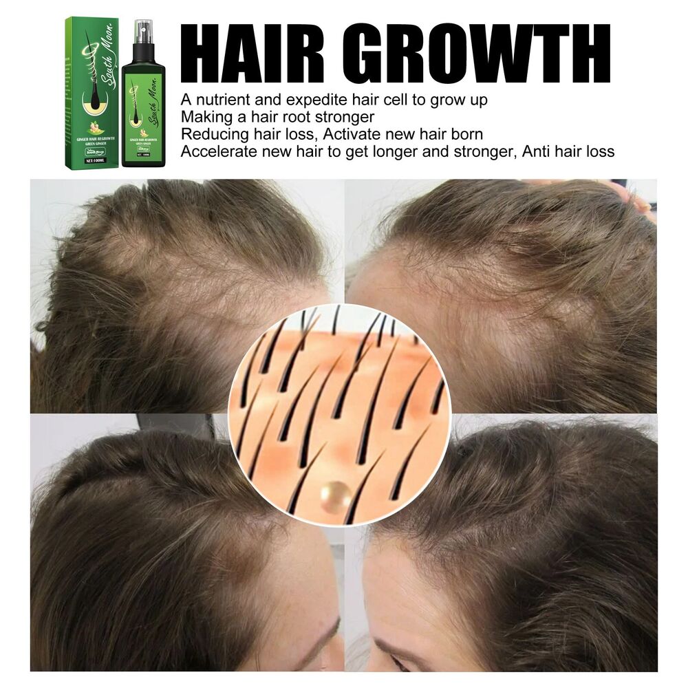 Nourishing Ginger Spray Hair Growth Essence Spray Fast Hair Growth Natural Hair