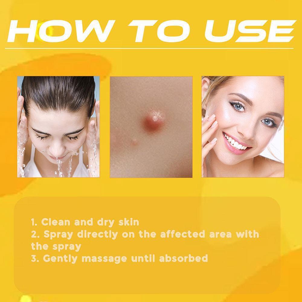 Tag Recede Bee Wart Treatment Spary, Bee Wart Removal Care Spray^