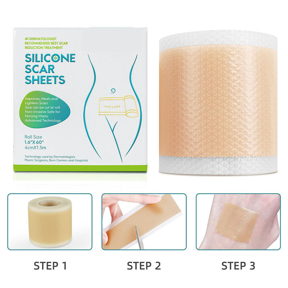 Silicone Gel Sheet Patch Medical Scar Removal Wound Skin Repair Treatment Tape