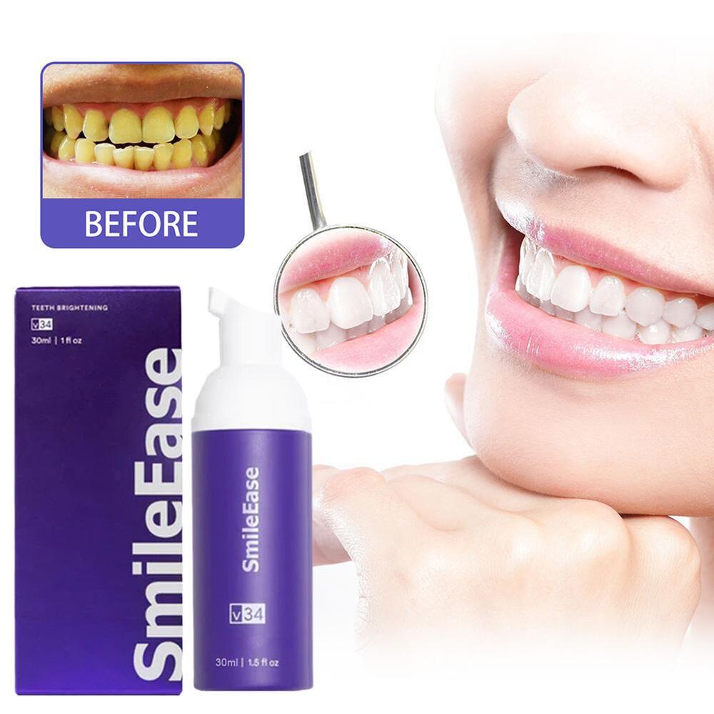 Smile Ease -Oral Care Mousse -NEW