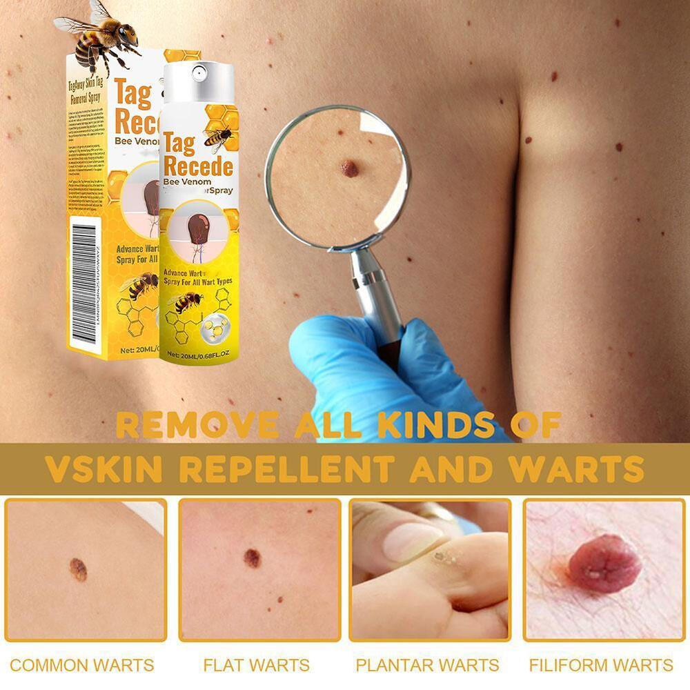 Tag Recede Bee Wart Treatment Spary, Bee Wart Removal Care Spray^