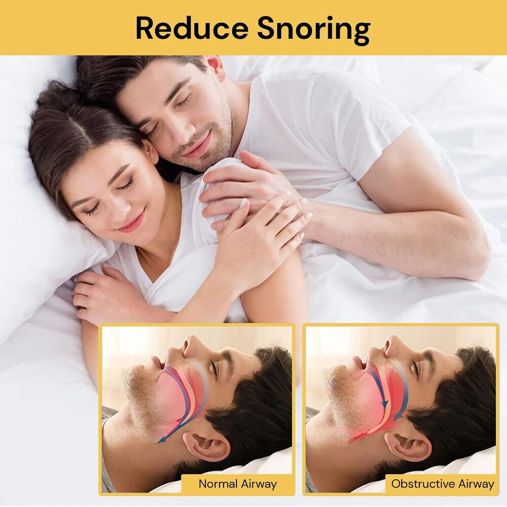 Night Mouth Guard Teeth Grinding Mouth Guard Bruxism Clenching Sleeping Dental