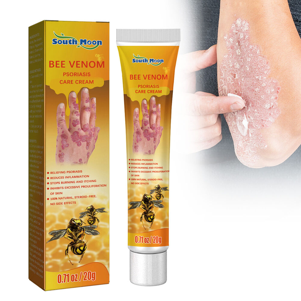 Bee Venom Psoriasis Cream Dermatitis Eczema Ointment Healing Antibacterial Cream