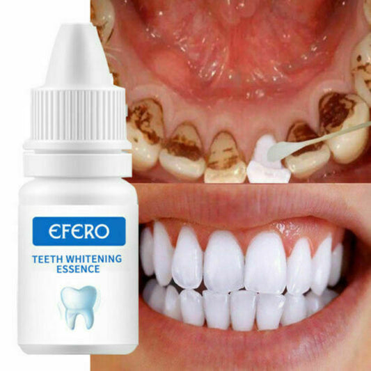 NEW INSTANT TOOTH WHITENING KIT WHITE TEETH CLEAN GEL UV BLEACH DENTAL STRENGTH