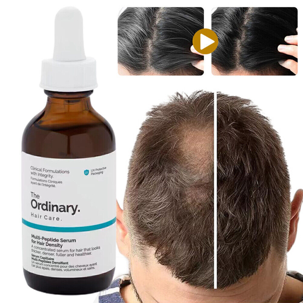 2X Multi Peptide Serum for Hair Density Hair Growth Serum Anti Hair Loss  60ML