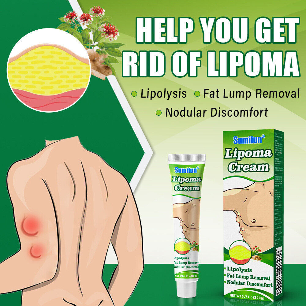 1 x Lipoma Cream Fat Lump Removal Treatment Skin Swelling Exfoliating Ointment