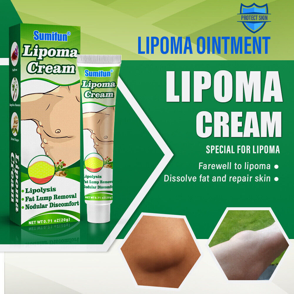 1 x Lipoma Cream Fat Lump Removal Treatment Skin Swelling Exfoliating Ointment