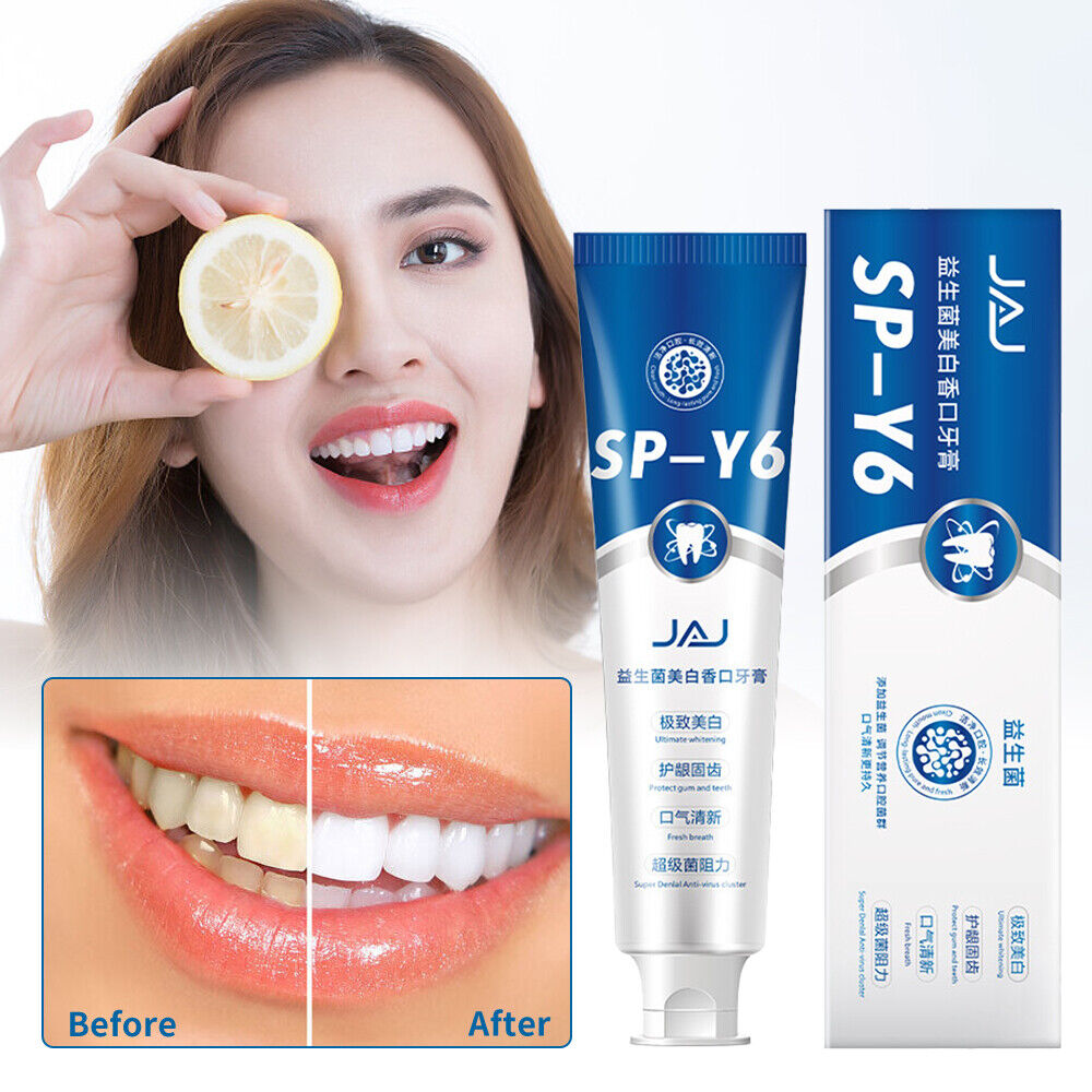 Probiotics Toothpaste, SP-Y6 Beneficial Bacteria Whitening Mouth Toothpaste #T