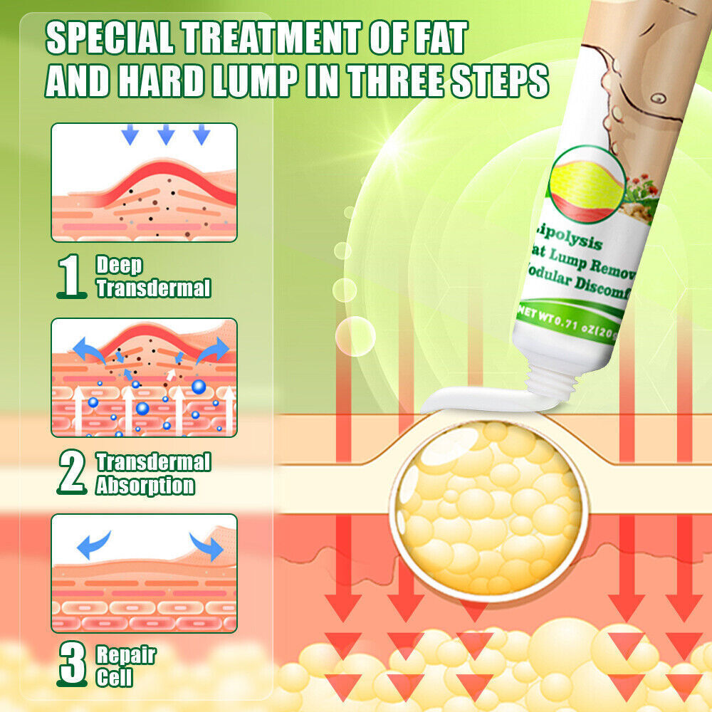 1 x Lipoma Cream Fat Lump Removal Treatment Skin Swelling Exfoliating Ointment