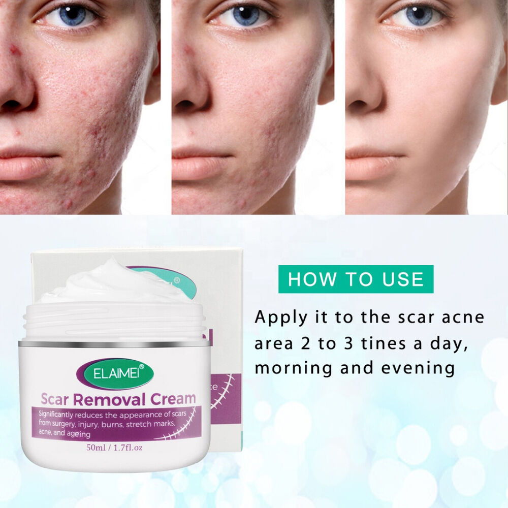 Scar Removal Treatment Cream Stretch Marks Skin Repair Advanced Face Body Heal