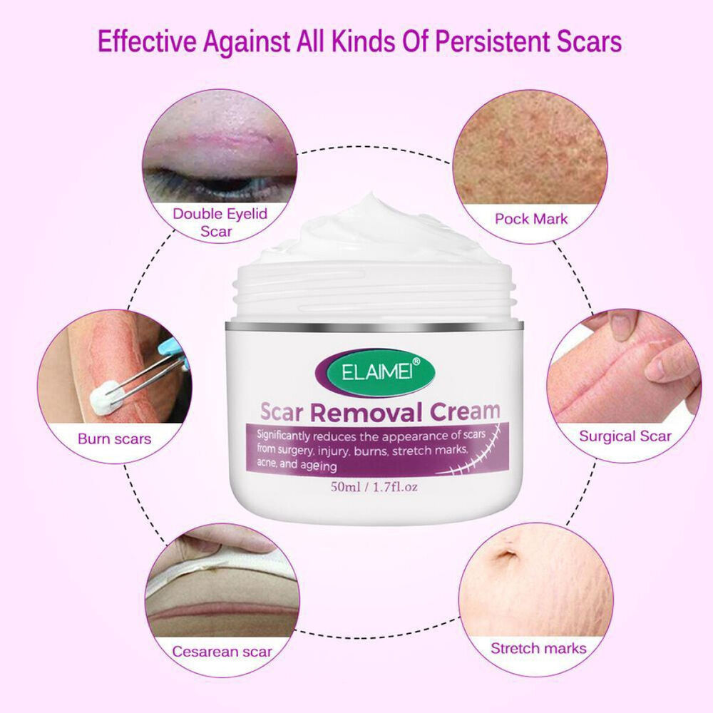 Scar Removal Treatment Cream Stretch Marks Skin Repair Advanced Face Body Heal