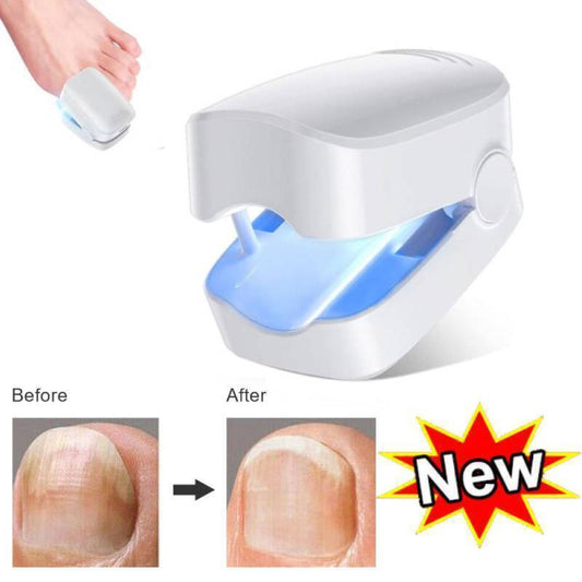 Nail Fungus Laser Device Light Therapy Onychomycosis Toes Treatment HOT