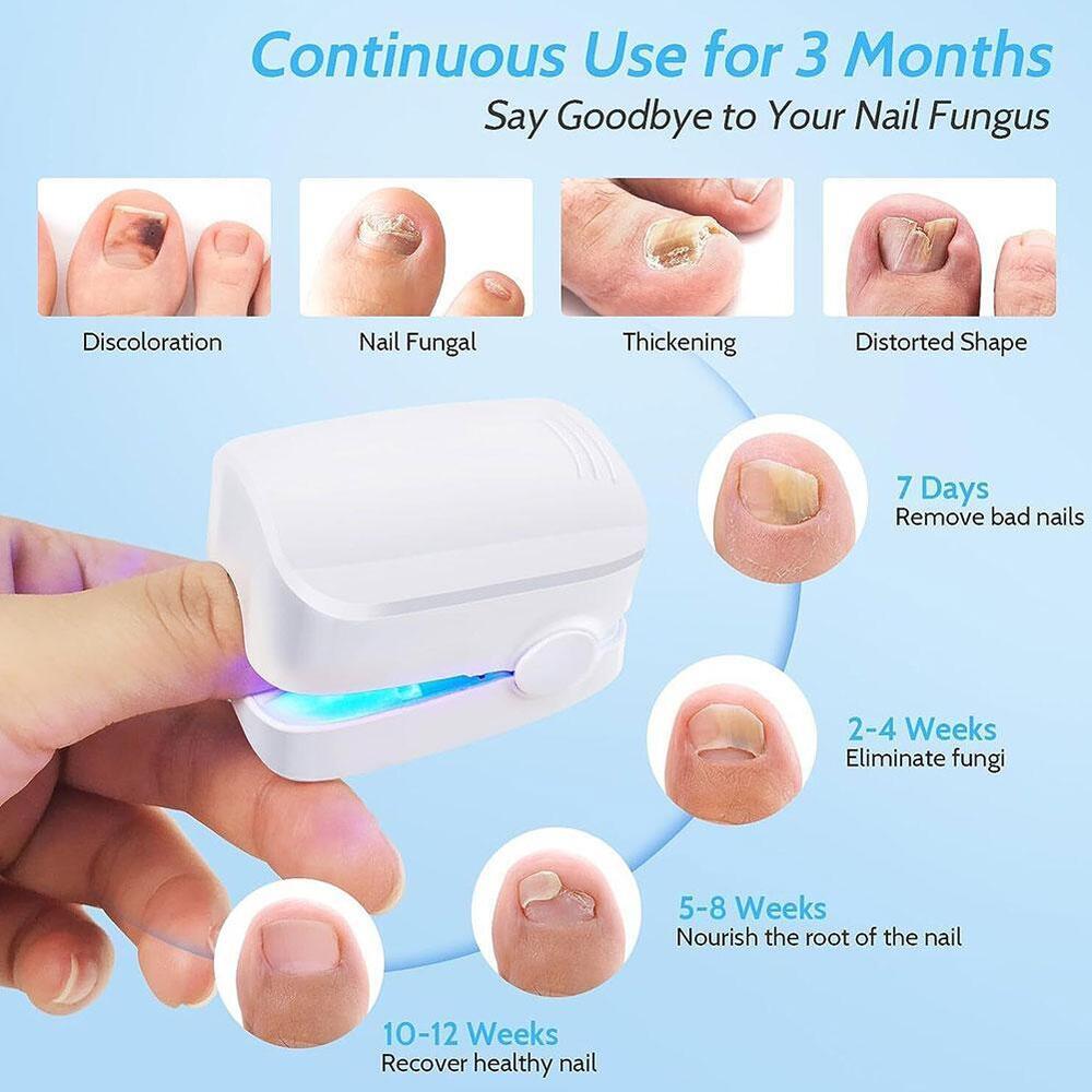 Nail Fungus Laser Device Light Therapy Antifungal Onychomycosis Toes Treatment