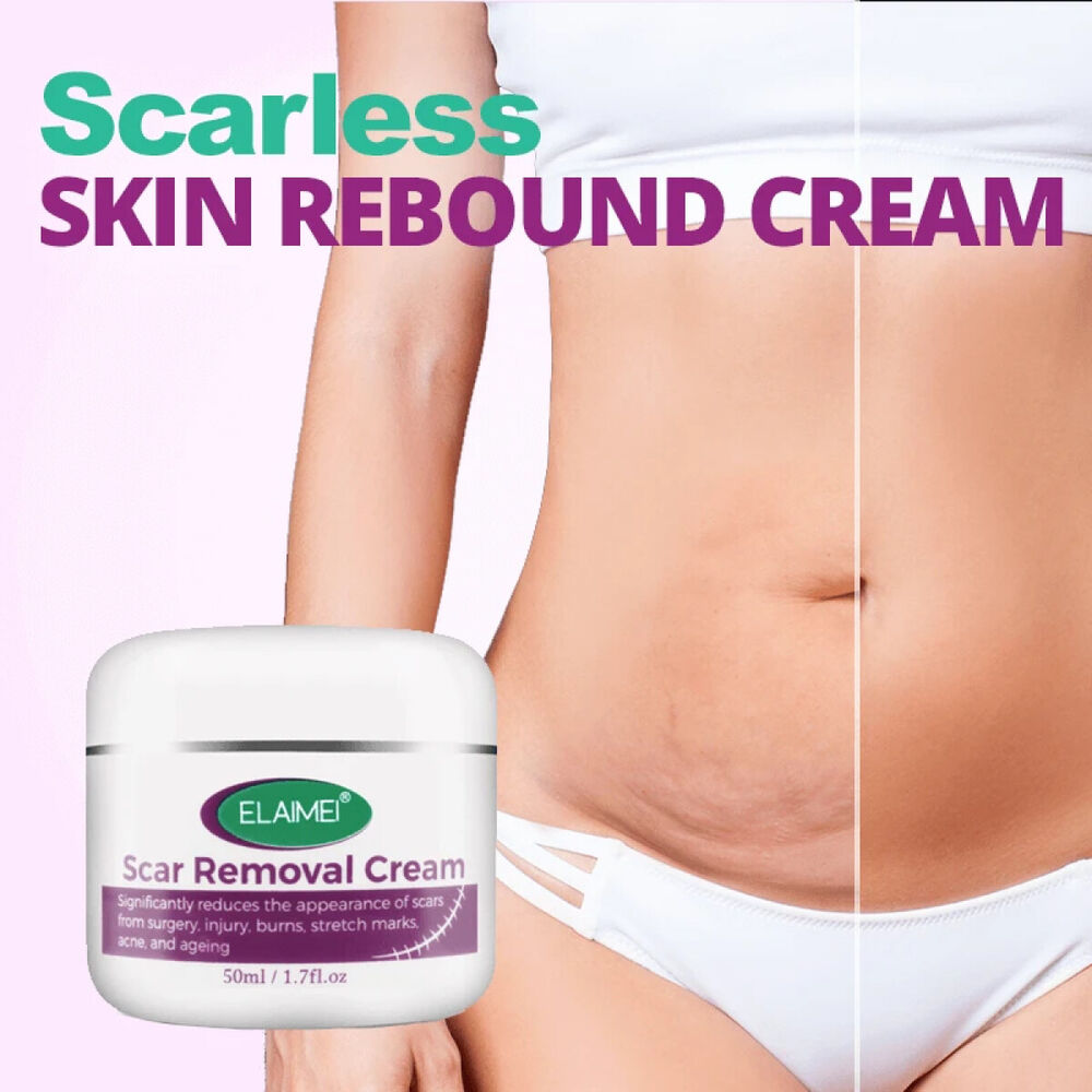 Scar Removal Treatment Cream Stretch Marks Skin Repair Advanced Face Body Heal