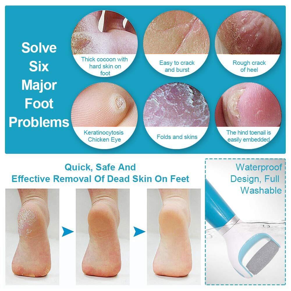 Scholl Velvet Smooth Pedi Diamond crystals Electric Foot File Hard Skin Removers