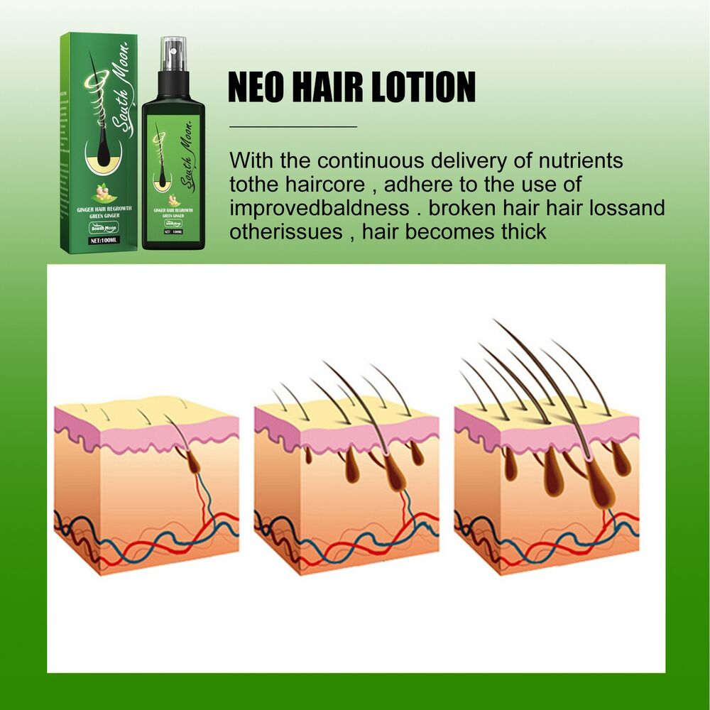 Nourishing Ginger Spray Hair Growth Essence Spray Fast Hair Growth Natural Hair