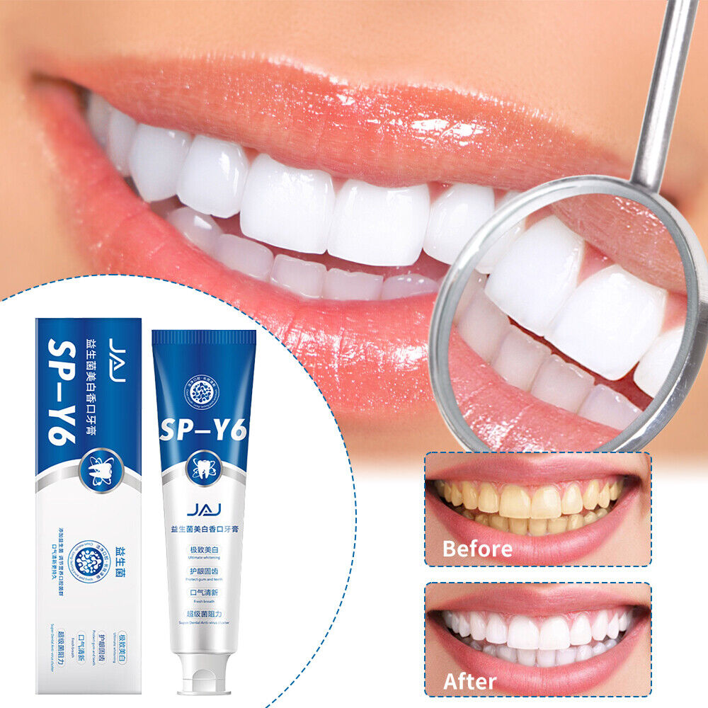 Probiotics Toothpaste, SP-Y6 Beneficial Bacteria Whitening Mouth Toothpaste #T