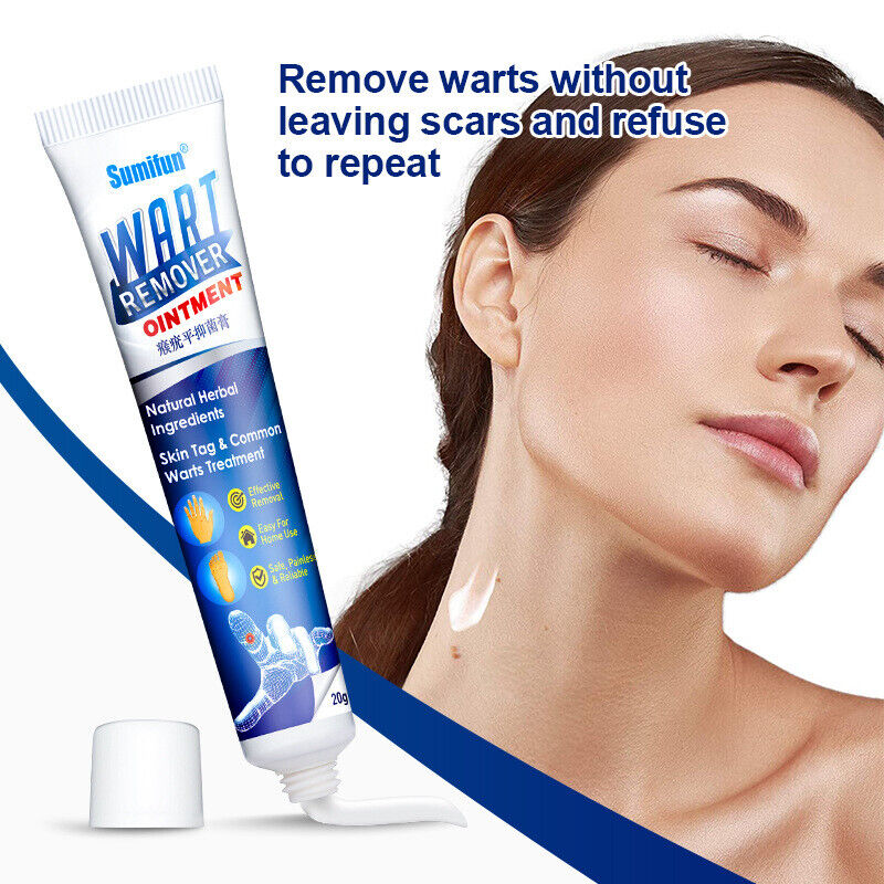 Wart Removal Body Warts Treatment Cream Foot Care Cream Skin Tag Remover