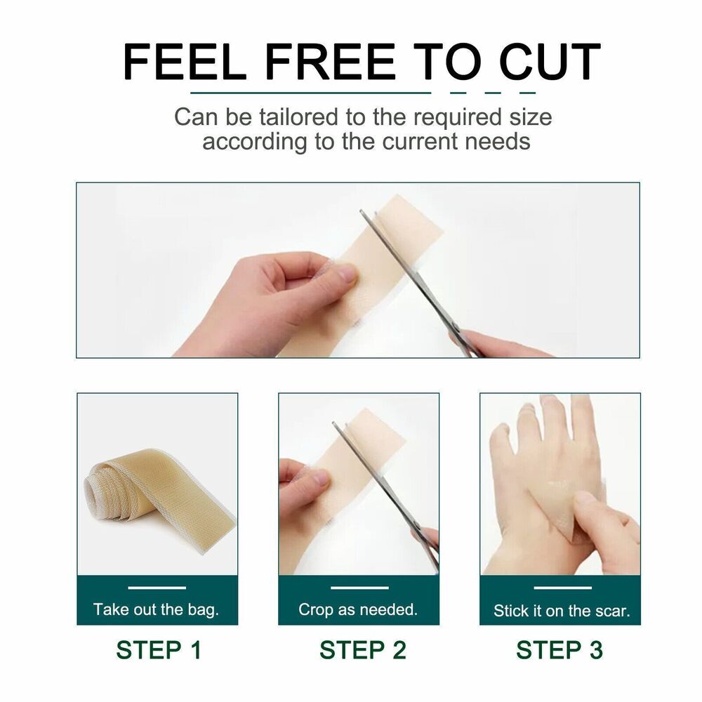 1.5M/Roll Silicone Gel Sheet Patch Scar Removal Wound Skin Repair Treatment Tape