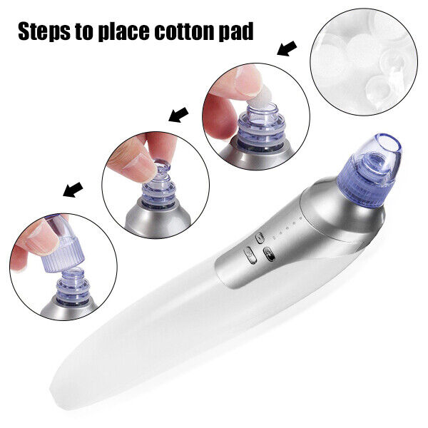 1 SET UBS Facial Blackhead Remover Vacuum Face Pore Pimple Suction Dermabrasion Tool