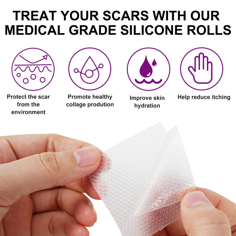 1.5m Silicone Scar Sheets Gel Tape Roll Scars Removal Skin Treatment Patch Tapes