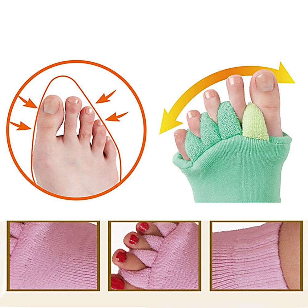 ONLY HAPPY FEET BRINGS YOU THIS TYPE OF FOOT RELIEF Toe Separator Alignment So#T