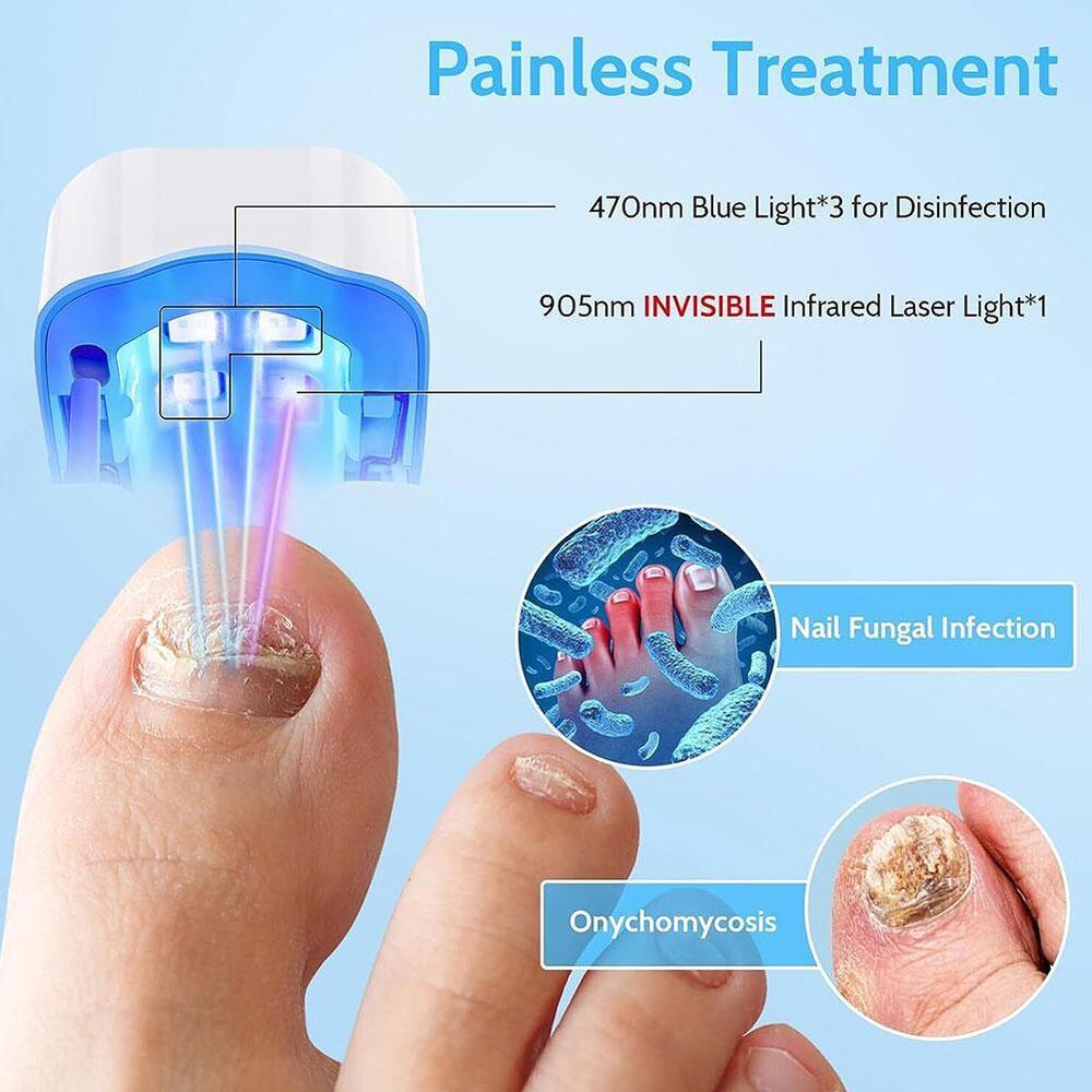 Nail Fungus Laser Device Light Therapy Antifungal Onychomycosis Toes Treatment