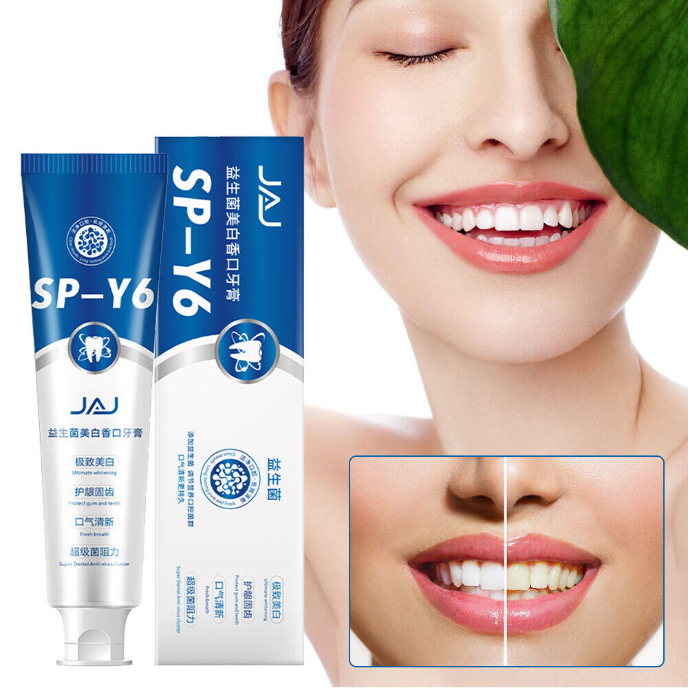 Probiotics Toothpaste, SP-Y6 Beneficial Bacteria Whitening Mouth Toothpaste #T