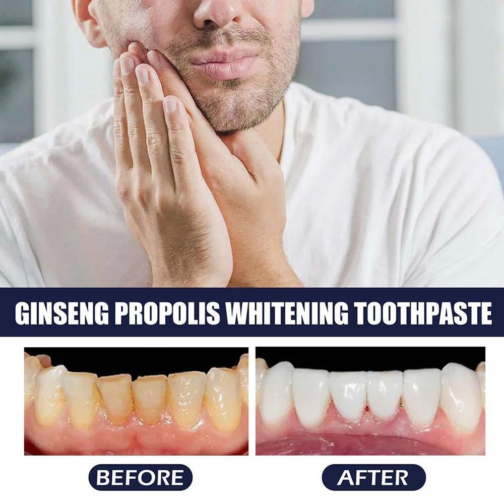 Ginseng Propolis Conservation Toothpaste，Loose Teeth Care Toothpaste