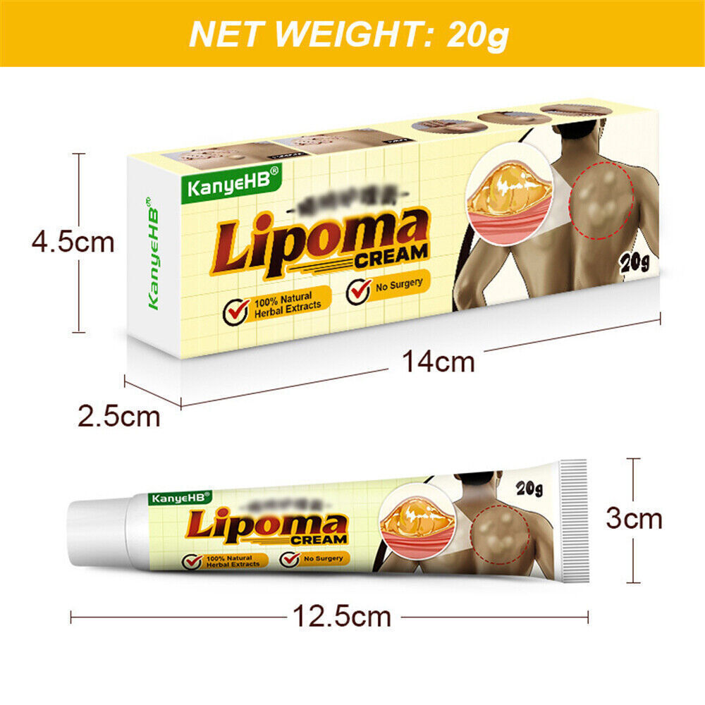 Lipoma Removal Cream Treatment Skin Swelling Ointment Exfoliating Pain Relief`