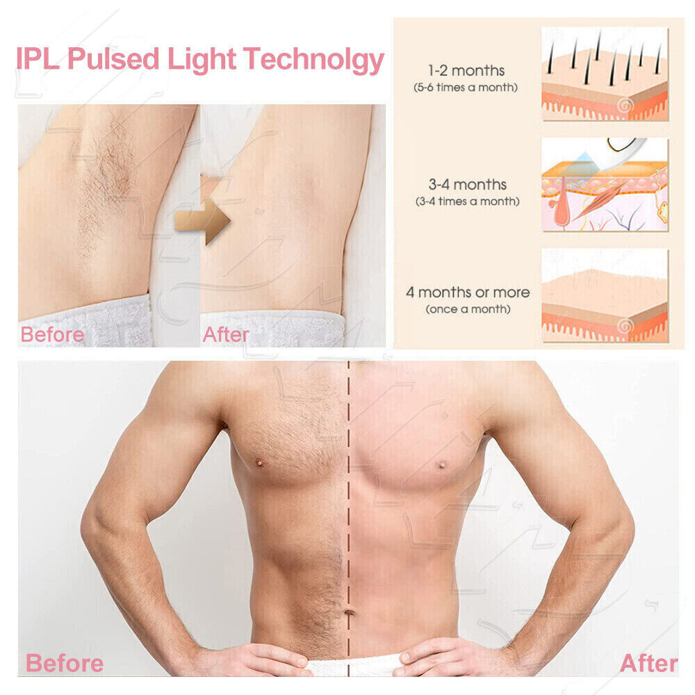 IPL Permanent Laser Hair Removal For Women Men Painless All Body Remover Device