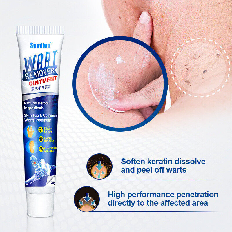 Wart Removal Body Warts Treatment Cream Foot Care Cream Skin Tag Remover