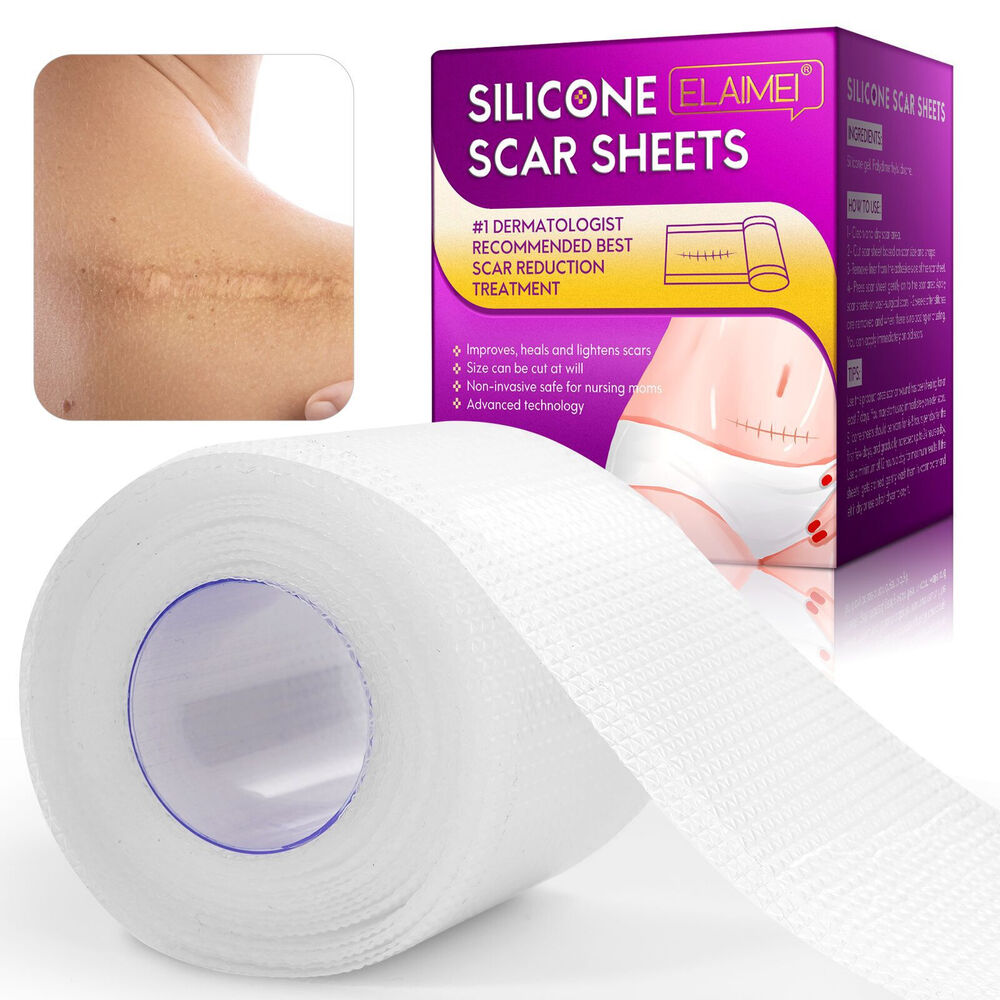 1.5m Silicone Scar Sheets Gel Tape Roll Scars Removal Skin Treatment Patch Tapes