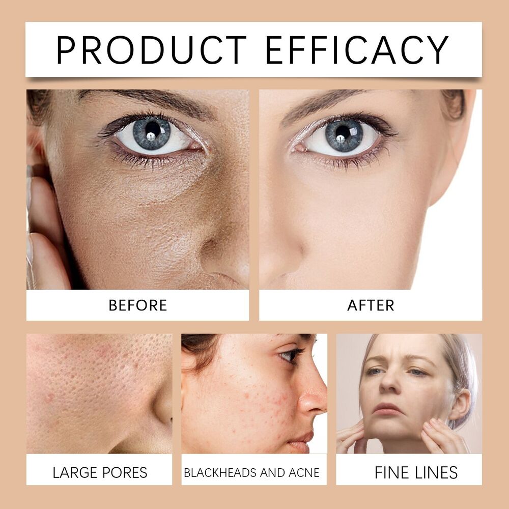 Anti-Blemish Ageing Wrinkle Tear-Off Mask Freckle Removal Sleep Face Beauty Mask