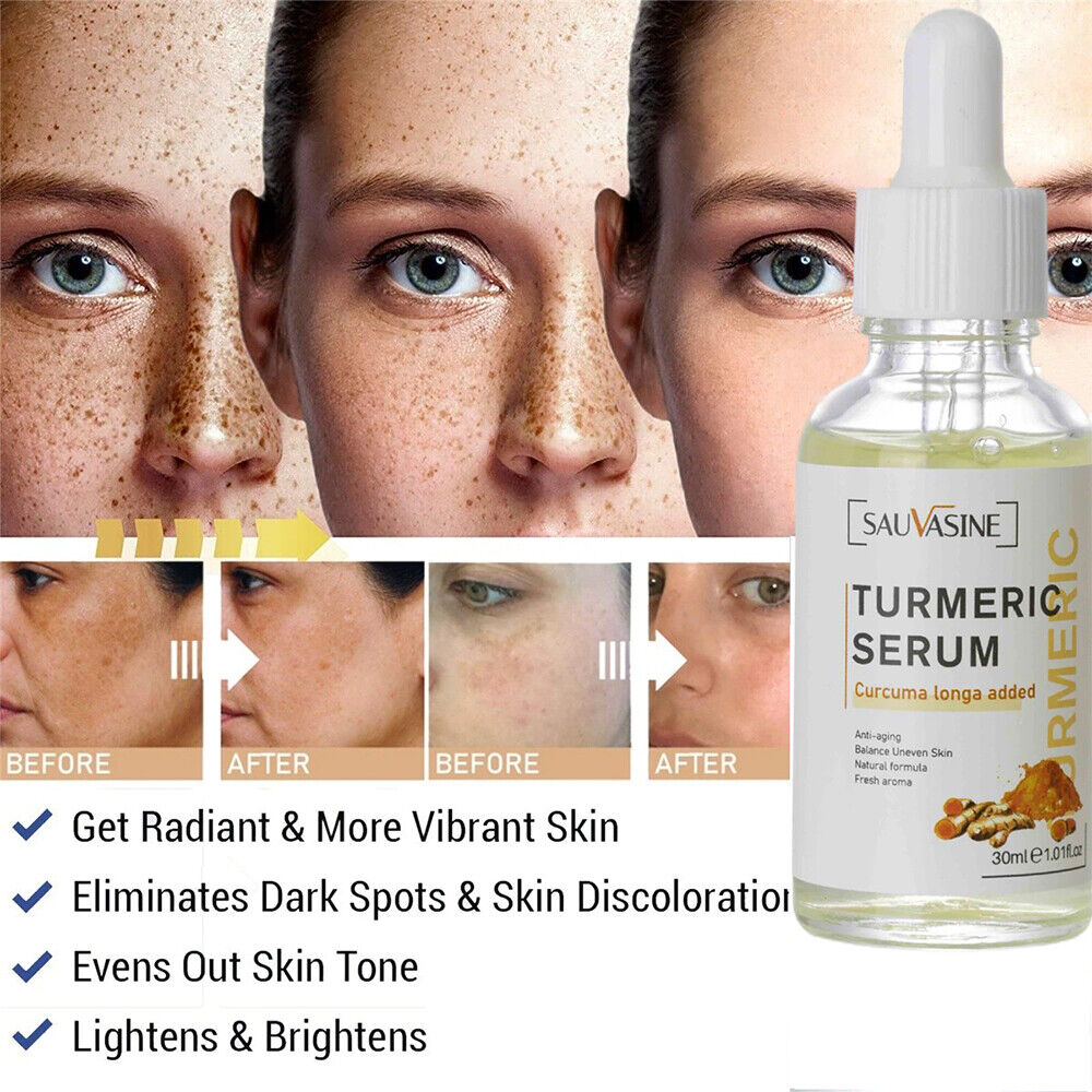 2~Turmeric Serum Dark Spot Corrector Remove Wrinkle Tumeric Face Whitening Cream