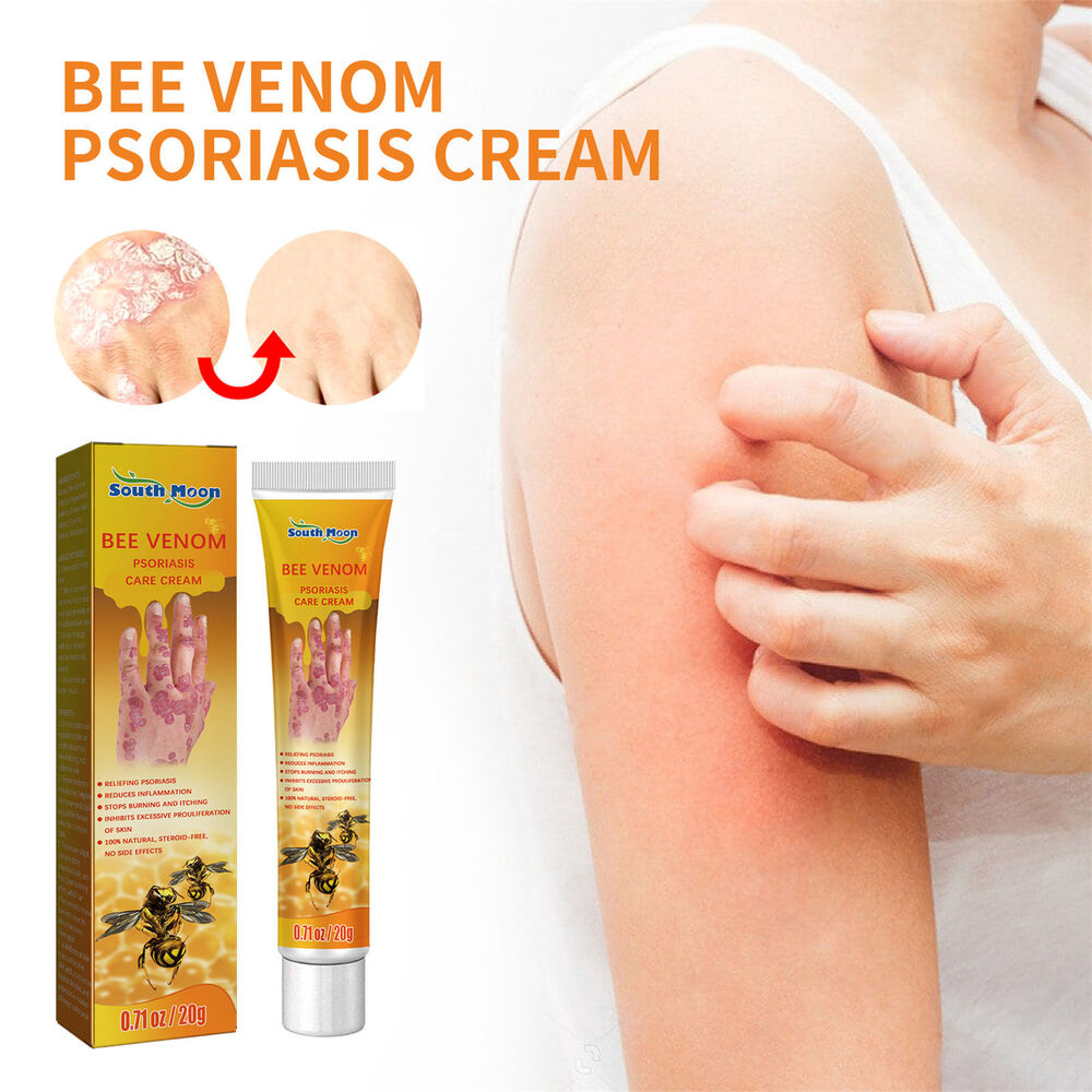 Bee Venom Psoriasis Cream Dermatitis Eczema Ointment Healing Antibacterial Cream