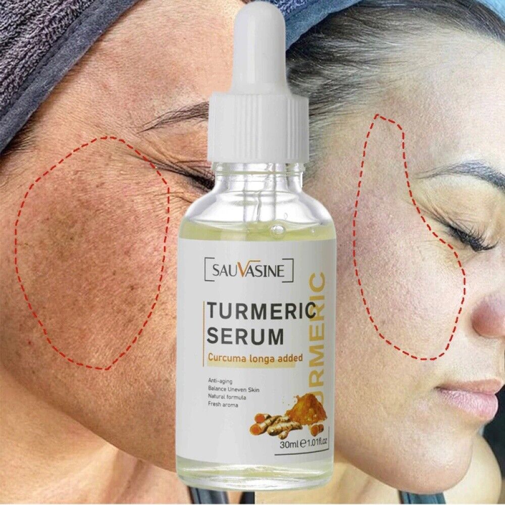 2~Turmeric Serum Dark Spot Corrector Remove Wrinkle Tumeric Face Whitening Cream