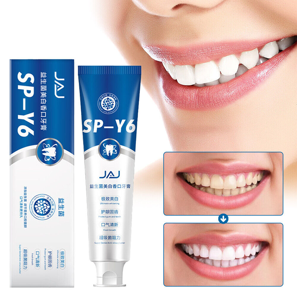 Probiotics Toothpaste, SP-Y6 Beneficial Bacteria Whitening Mouth Toothpaste #T