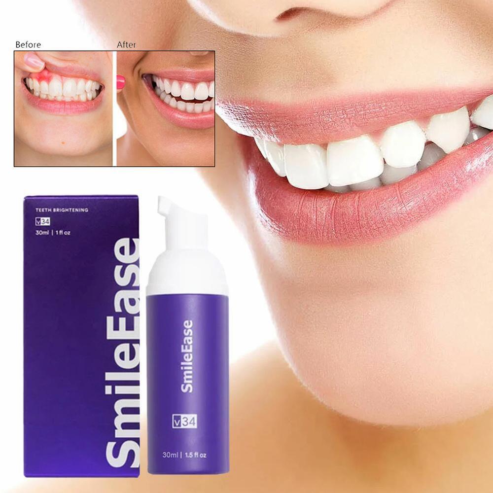 Smile Ease -Oral Care Mousse -NEW