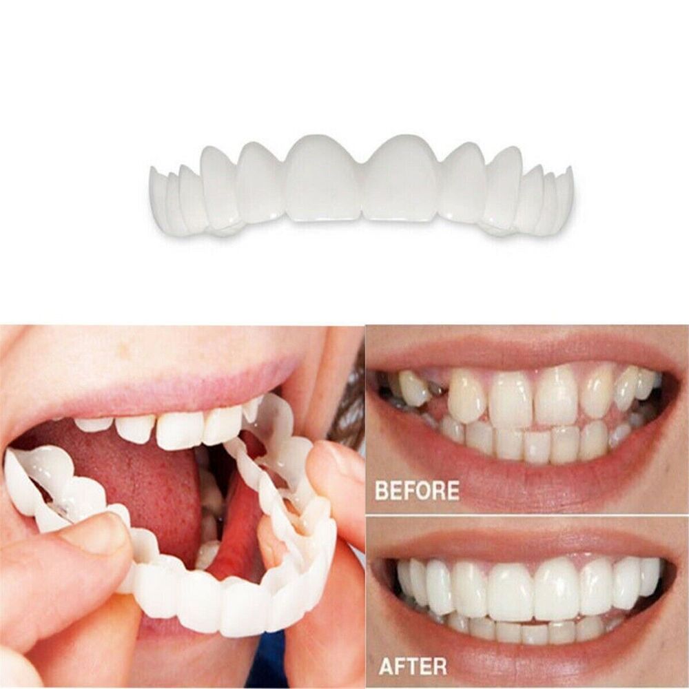 Snap On Bottom &Upper Lower False Teeth Dental Veneers Dentures Fake Tooth Smile